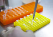 分子生物学检测